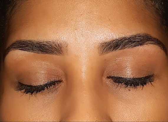 Epilation Sourcils
